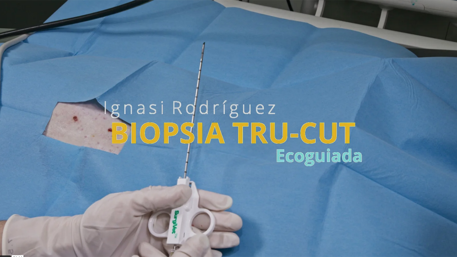 Biopsia Tru-Cut ecoguiada