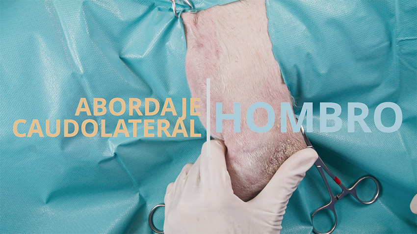 Abordaje caudolateral al hombro