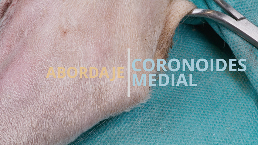 Abordaje al proceso coronoideo medial