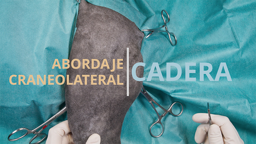 Abordaje craneolateral a la cadera