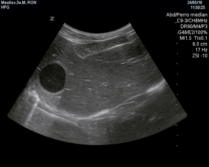 Imágenes fisiológicas en la ecografía hepática