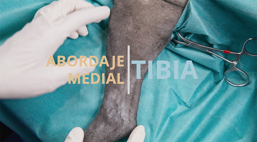 Abordaje medial a la tibia