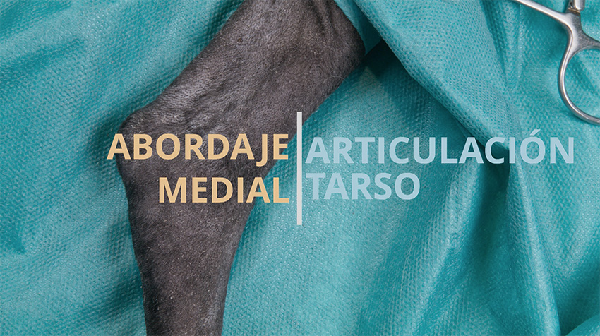 Abordaje medial al tarso